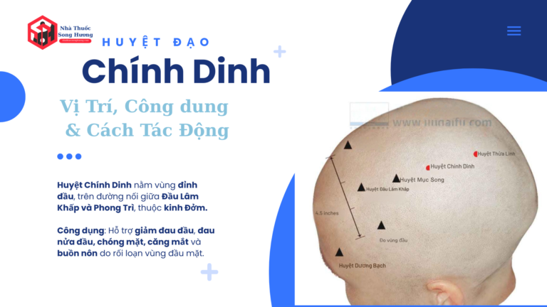Hình ảnh vị trí huyệt Chính Dinh (GB17) trên đỉnh đầu theo Đông y, hướng dẫn xác định huyệt thuộc kinh Đởm hỗ trợ giảm đau đầu, đau nửa đầu, chóng mặt và căng mắt.